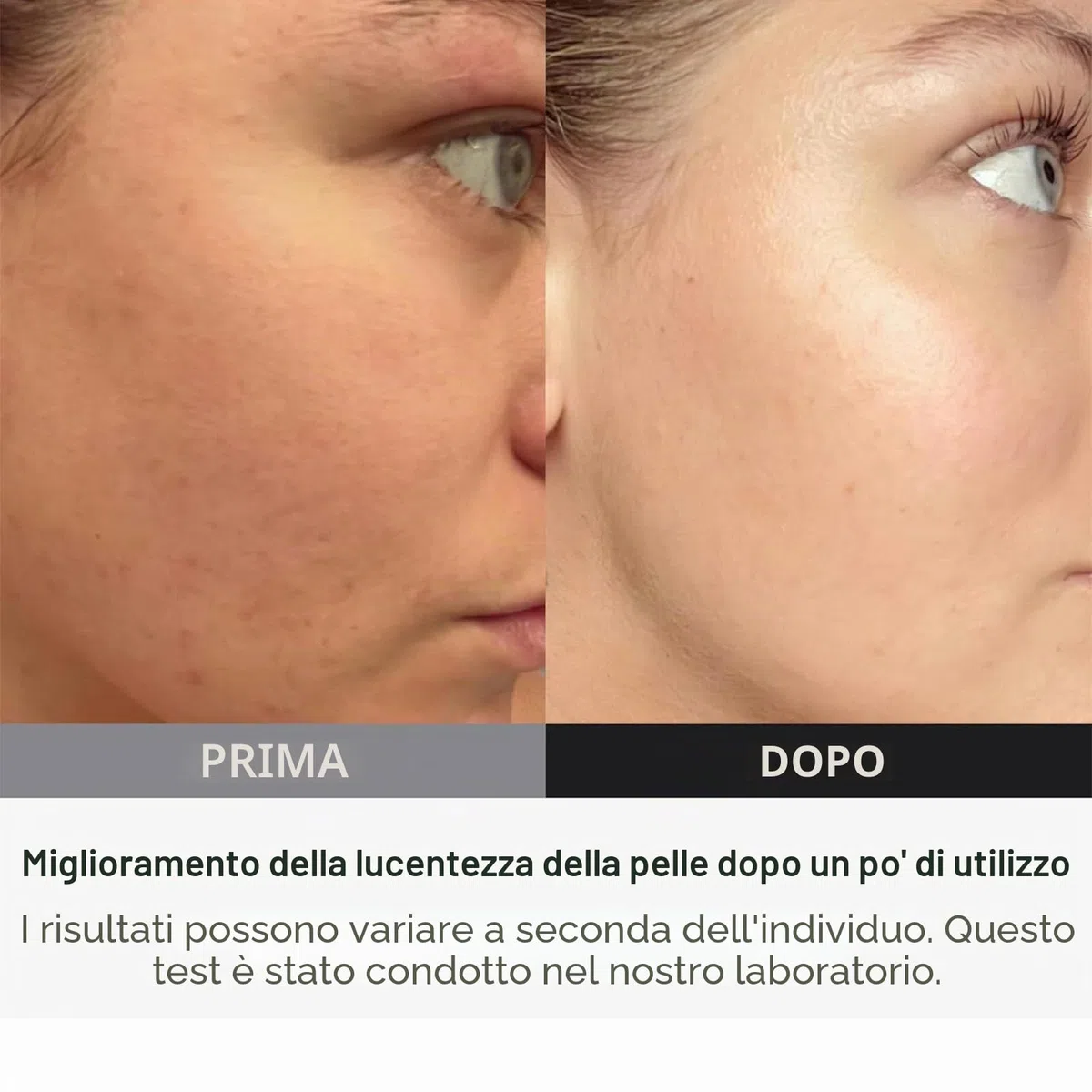 Lampada a Luce Rossa, 660nm Con Supporto e Occhiali Per Uso Domestico, 127 LEDs a Luce Rossa Per La Terapia Dei Muscoli, Recupero del Corpo